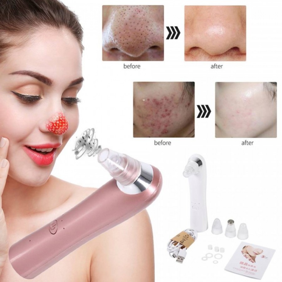 Aparat vacuum pentru curatat si ingrijire a pielii de acnee. Aparat Extractie Puncte Negre, tip Vacuum / Aspirator, 4 Capete de Schimb, 4 Programe, Reincarcabil, fara fir - Ingrijire Personala - wowreduceri.ro